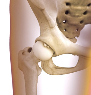 Intraarticular Synovitis 